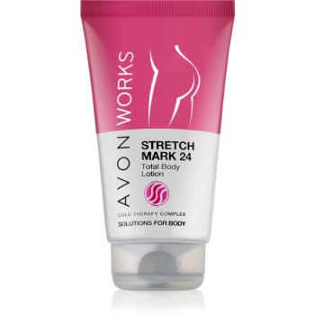 Avon Works Stretch Mark 24 mleczko do ciała przeciw rozstępom 150 ml